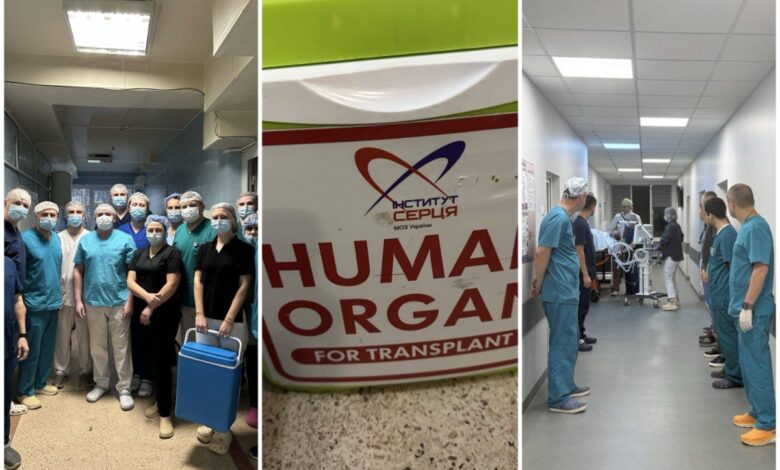 трансплантація органів в Одесі
