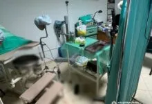 нелегальний аборт