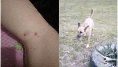 собака покусала жінку в Корабельному