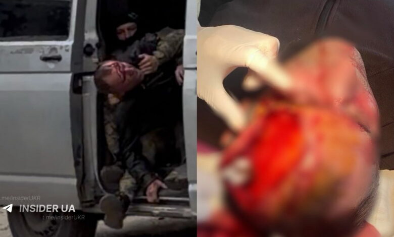 "Сам розбив голову": Волинський ТЦК відреагував на відео, яке розлетілося соцмережами