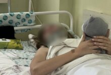 Дівчина Альона, яка дивом вижила у страшному ДТП (фото Суспільне Миколаїв/Назарій Рубаняк)