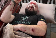 У Затоці місцевий житель побив ветерана АТО