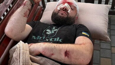 У Затоці місцевий житель побив ветерана АТО